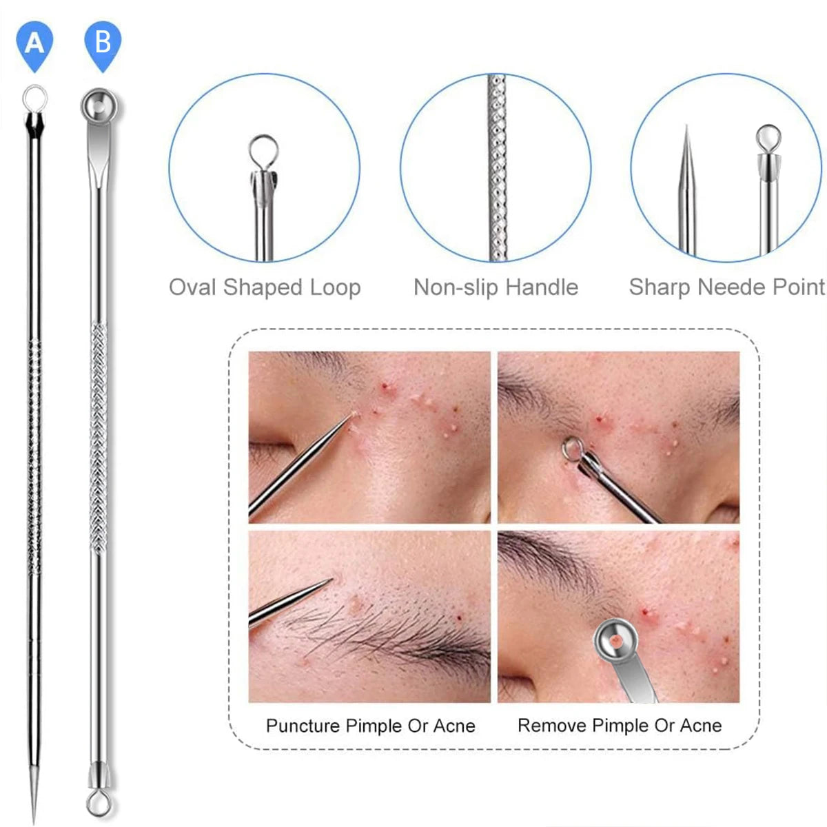 4PCS Blackhead & Pimple Remover Set - Acne Treatment Tools